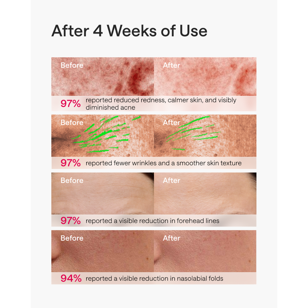 Ulike ReGlow Pro LED Light Therapy Mask