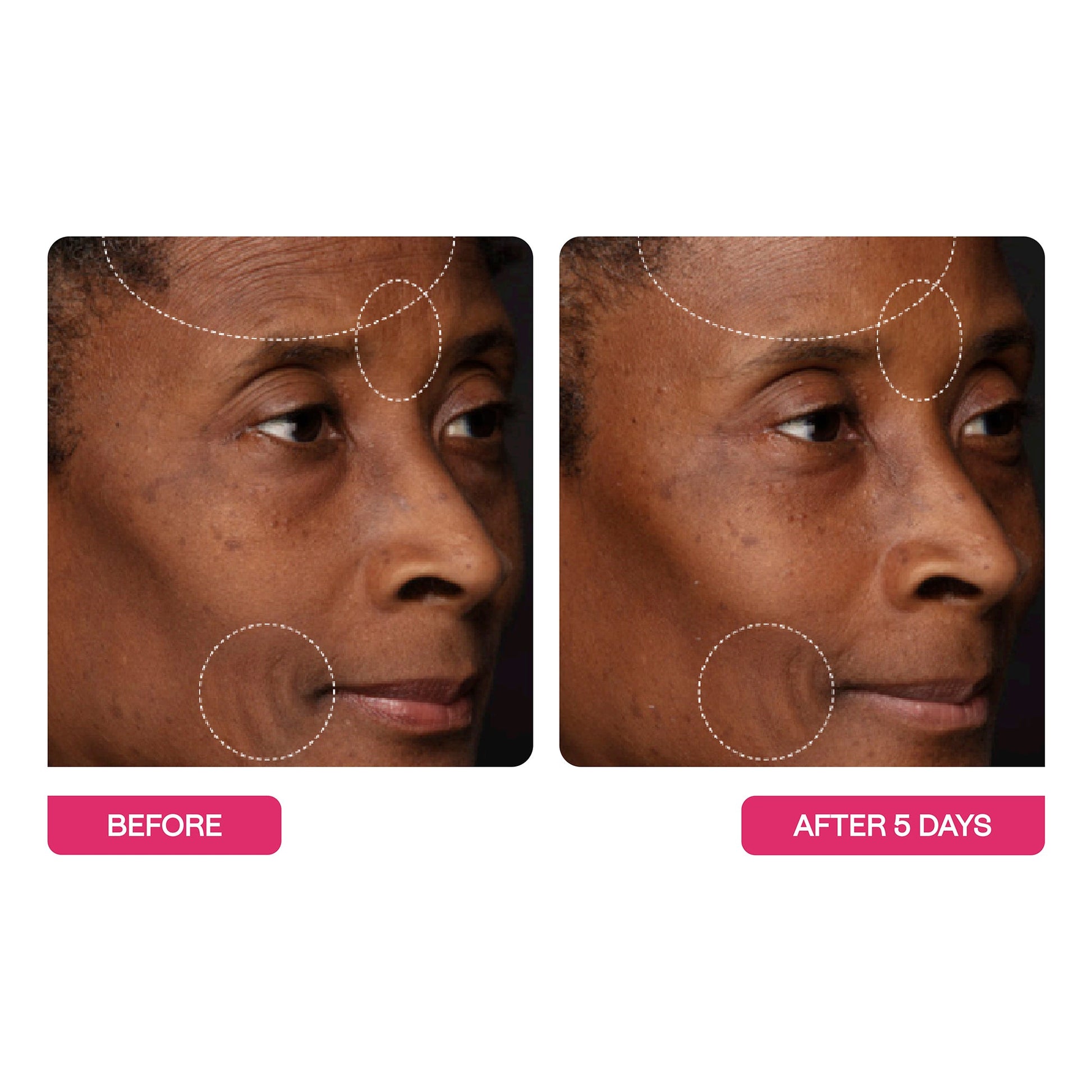 Peptide Wrinkle Relaxing Moisturizer 50ml