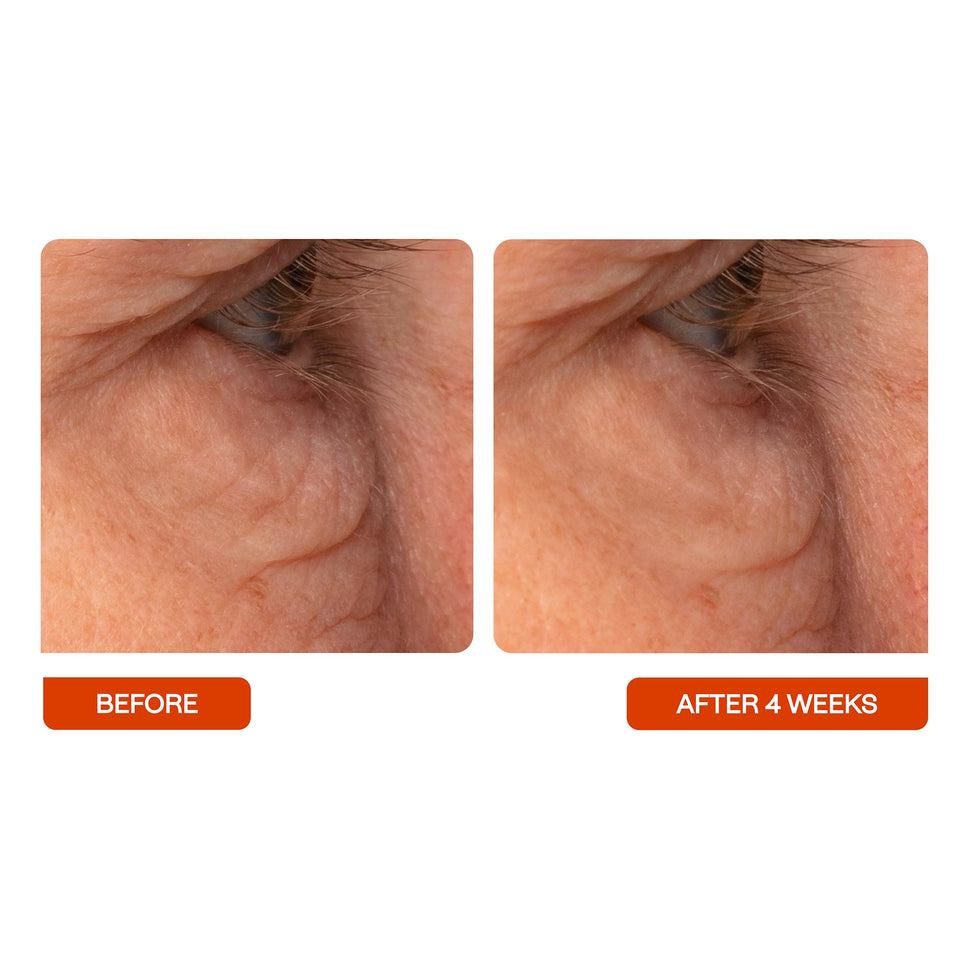 Universal C Eye Perfector 15ml