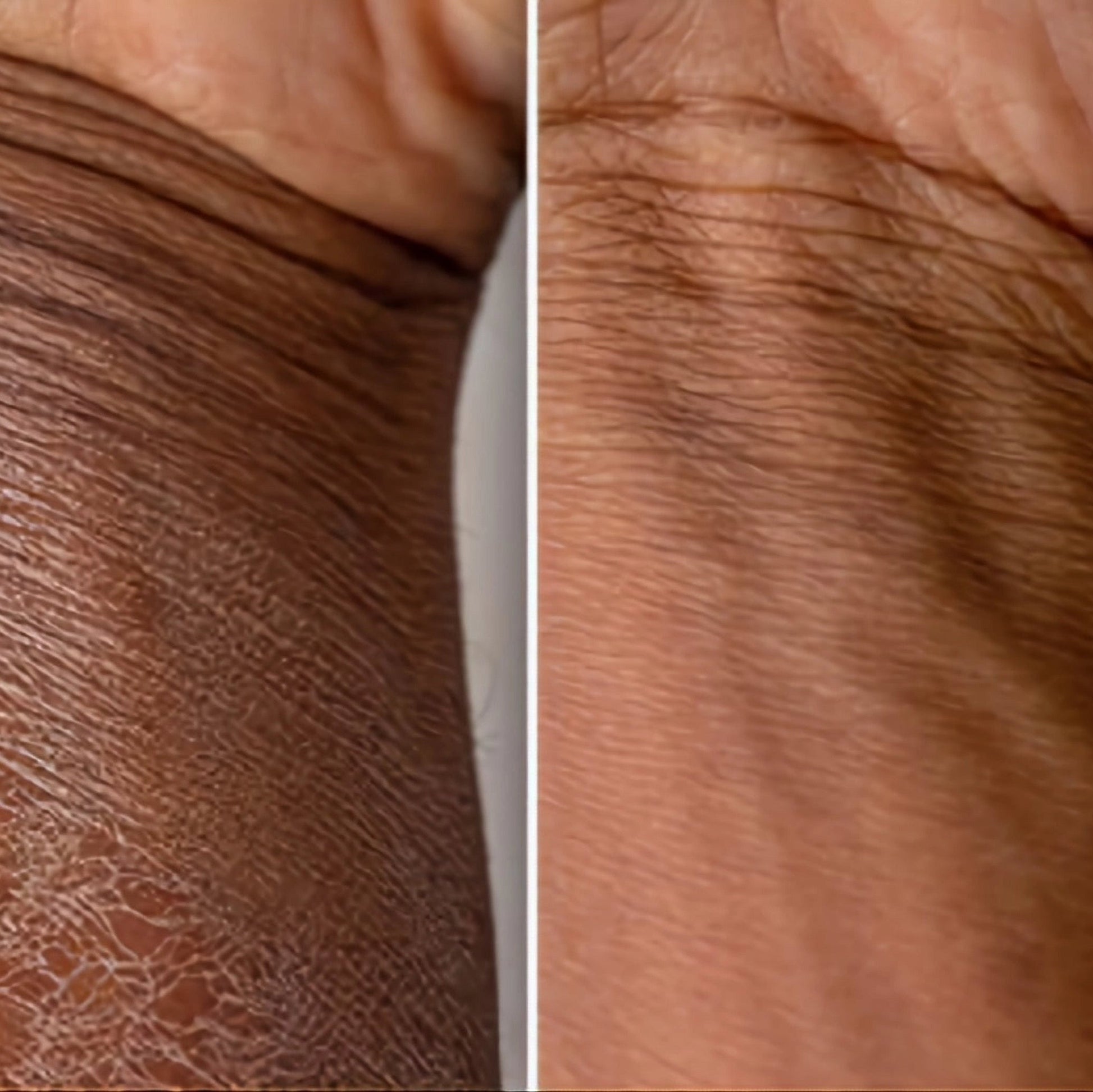 "Sweet Embrace" Triple Whipped Moisturizing Body Butter