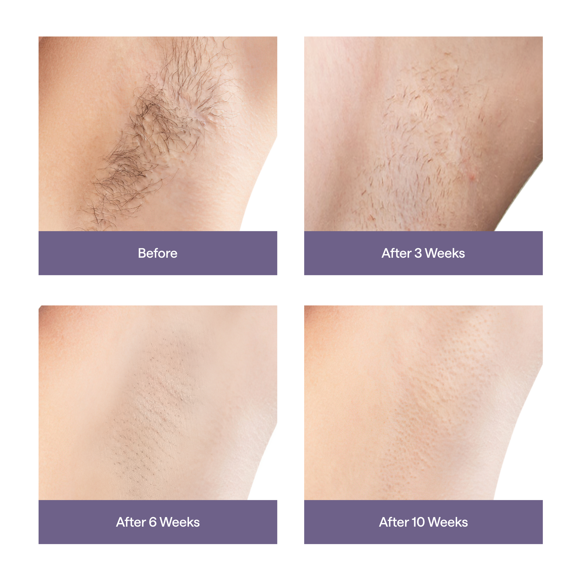 Ulike Air 3 - IPL Hair Removal Device